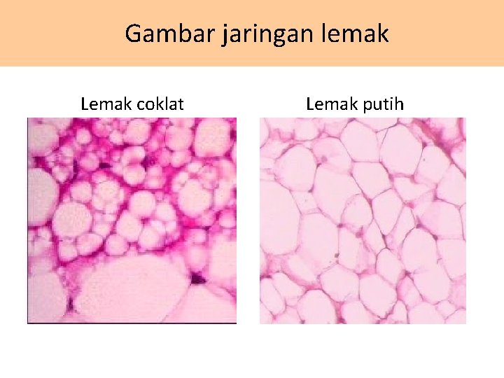 Gambar jaringan lemak Lemak coklat Lemak putih 