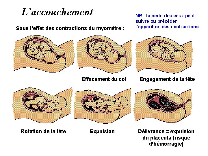 L’accouchement Sous l’effet des contractions du myomètre : Effacement du col Rotation de la