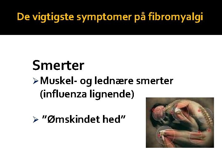 De vigtigste symptomer på fibromyalgi Smerter Ø Muskel- og lednære smerter (influenza lignende) Ø