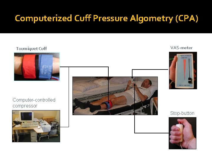 Computerized Cuff Pressure Algometry (CPA) Tourniquet Cuff VAS-meter Computer-controlled compressor Stop-button 