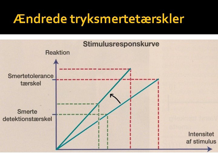 Ændrede tryksmertetærskler 
