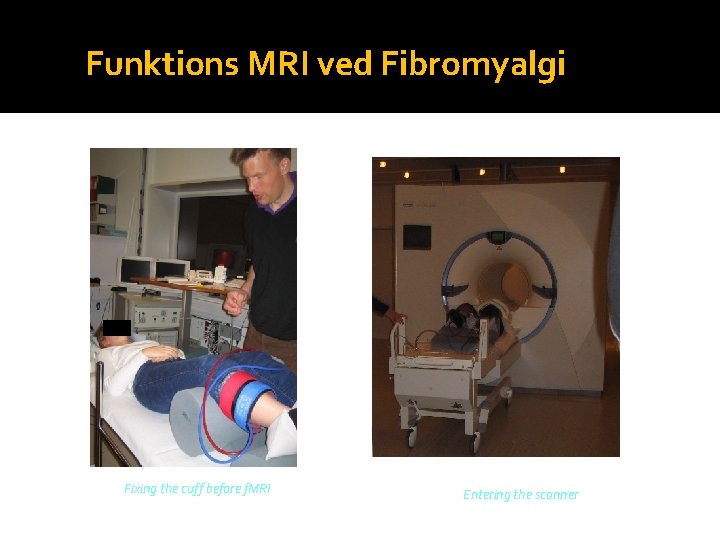 Funktions MRI ved Fibromyalgi Fixing the cuff before f. MRI Entering the scanner 