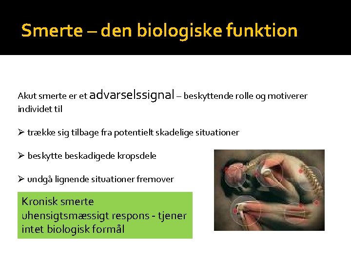 Smerte – den biologiske funktion Akut smerte er et advarselssignal – beskyttende rolle og