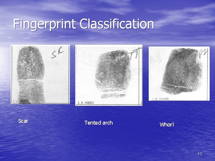 Fingerprint Classification Scar Tented arch Whorl 17 