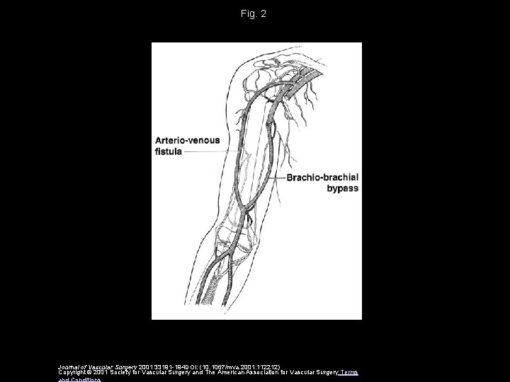 Fig. 2 Journal of Vascular Surgery 2001 33191 -194 DOI: (10. 1067/mva. 2001. 112212)