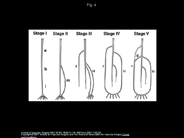 Fig. 4 Journal of Vascular Surgery 2001 33191 -194 DOI: (10. 1067/mva. 2001. 112212)