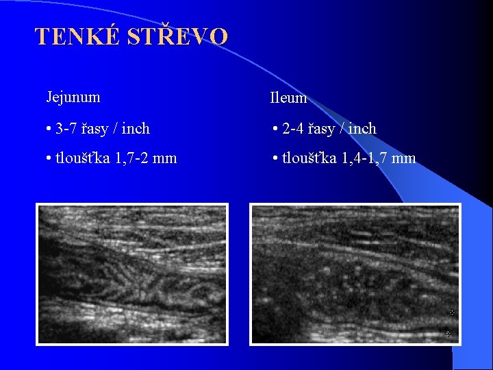 TENKÉ STŘEVO Jejunum Ileum • 3 -7 řasy / inch • 2 -4 řasy