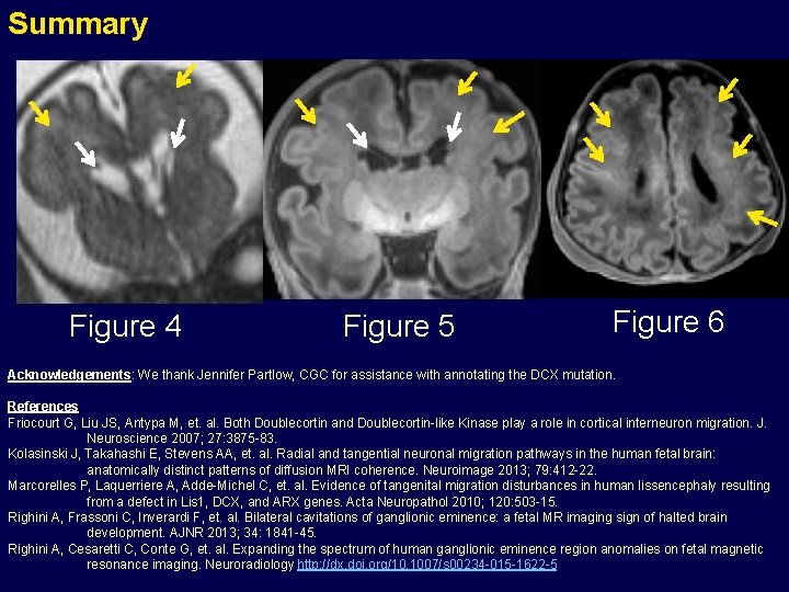 Summary Figure 4 Figure 5 Figure 6 Acknowledgements: We thank Jennifer Partlow, CGC for