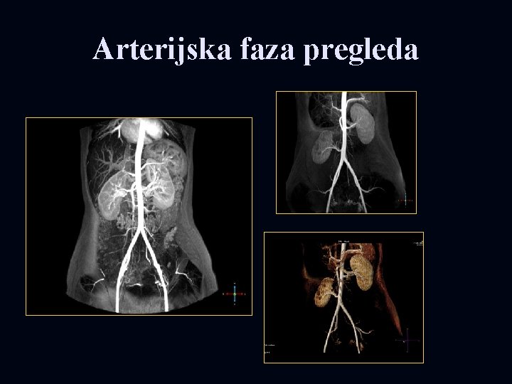 Arterijska faza pregleda 