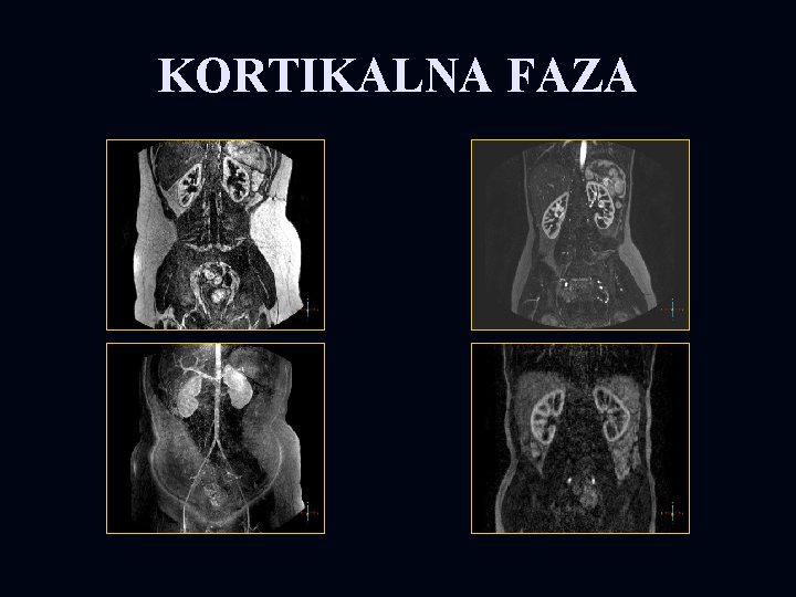 KORTIKALNA FAZA 