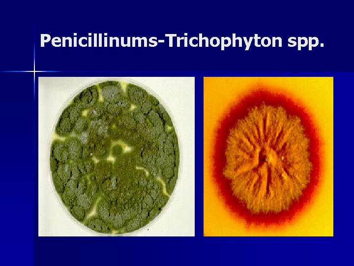 Penicillinums-Trichophyton spp. 