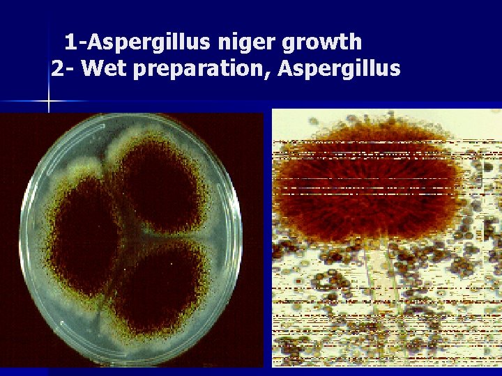 1 -Aspergillus niger growth 2 - Wet preparation, Aspergillus 