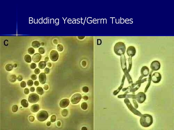 Budding Yeast/Germ Tubes 