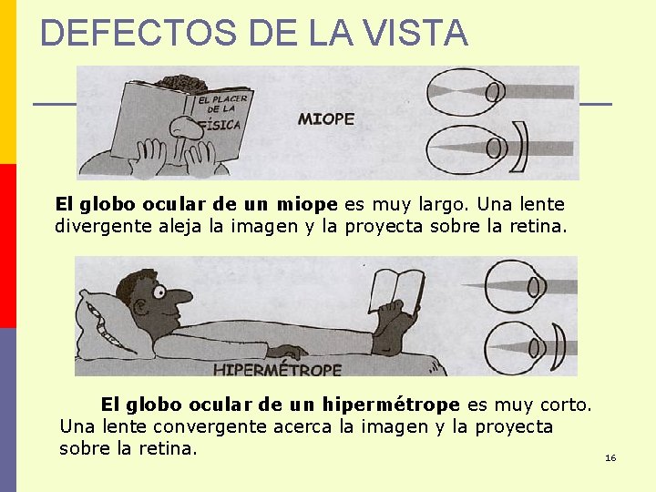 DEFECTOS DE LA VISTA El globo ocular de un miope es muy largo. Una