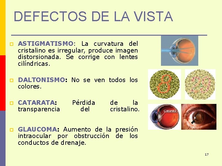 DEFECTOS DE LA VISTA p ASTIGMATISMO: La curvatura del cristalino es irregular, produce imagen