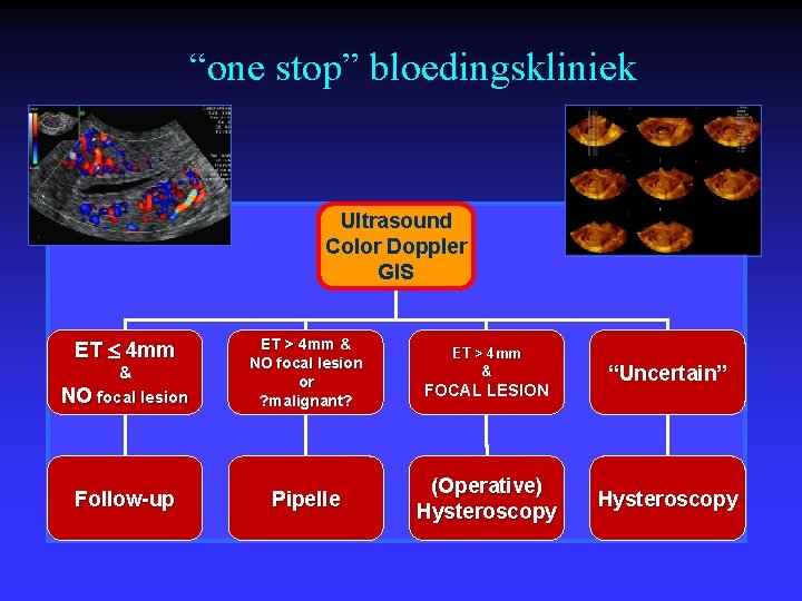 “one stop” bloedingskliniek Ultrasound Color Doppler GIS & NO focal lesion ET > 4