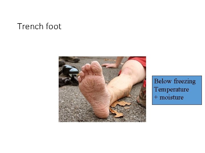 Trench foot Below freezing Temperature + moisture 
