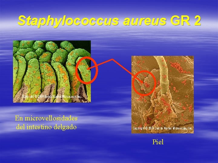 Staphylococcus aureus GR 2 En microvellosidades del intestino delgado Piel 