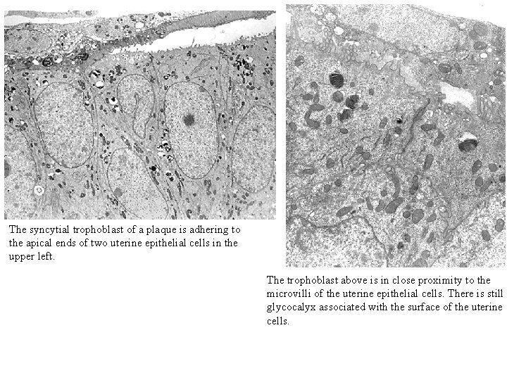 The syncytial trophoblast of a plaque is adhering to the apical ends of two