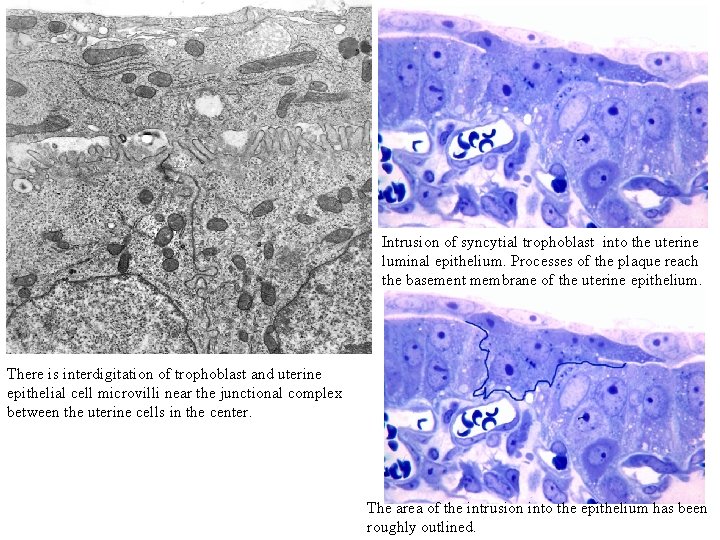 Intrusion of syncytial trophoblast into the uterine luminal epithelium. Processes of the plaque reach