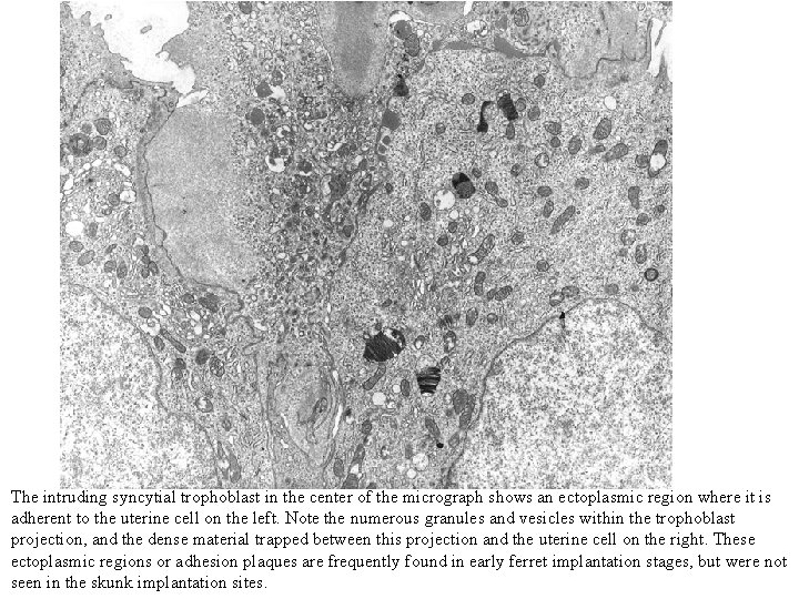 The intruding syncytial trophoblast in the center of the micrograph shows an ectoplasmic region