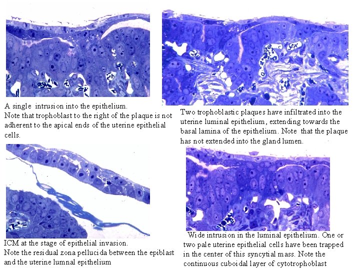 A single intrusion into the epithelium. Note that trophoblast to the right of the