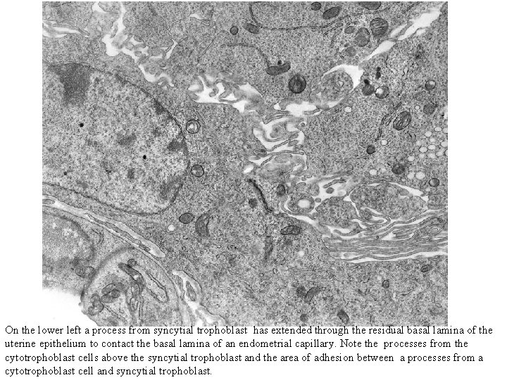 On the lower left a process from syncytial trophoblast has extended through the residual