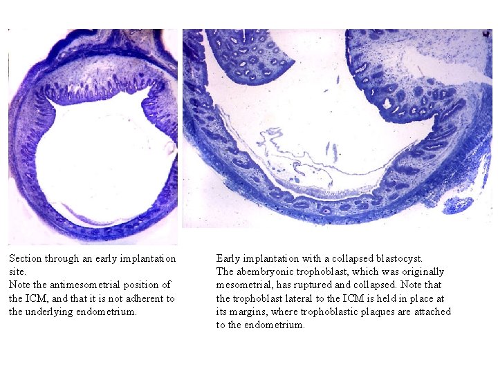 Section through an early implantation site. Note the antimesometrial position of the ICM, and