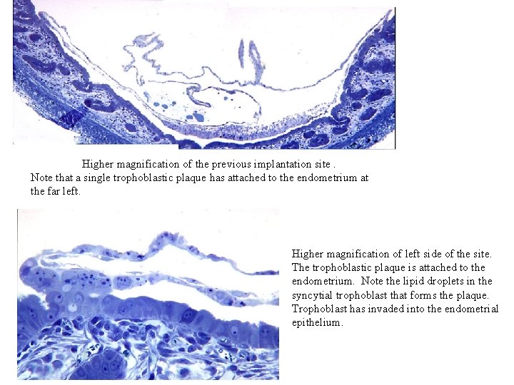 Higher magnification of the previous implantation site. Note that a single trophoblastic plaque has