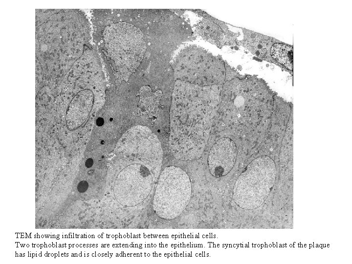 TEM showing infiltration of trophoblast between epithelial cells. Two trophoblast processes are extending into