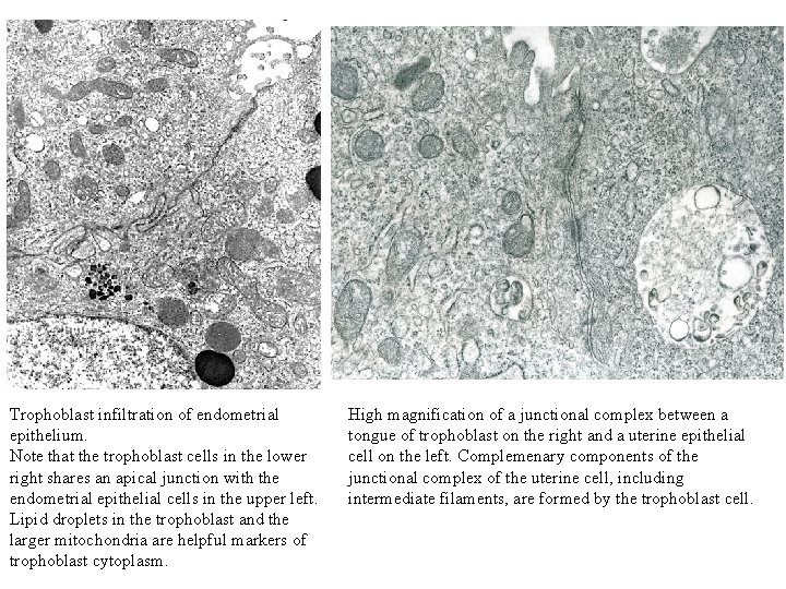 Trophoblast infiltration of endometrial epithelium. Note that the trophoblast cells in the lower right