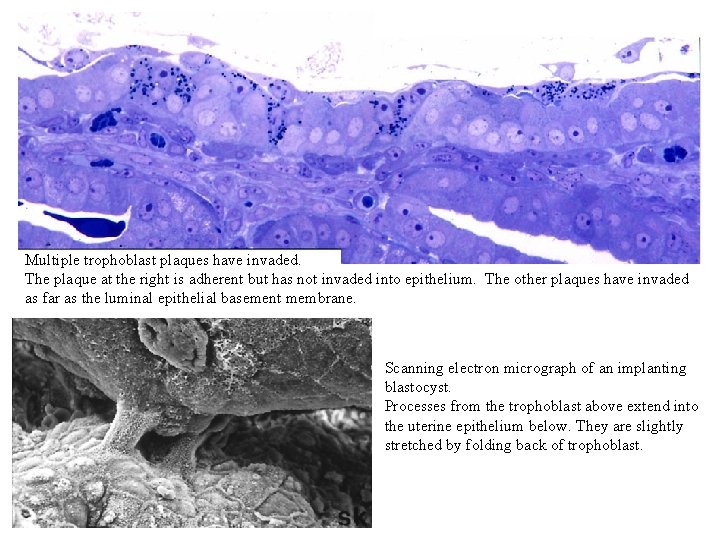 Multiple trophoblast plaques have invaded. The plaque at the right is adherent but has