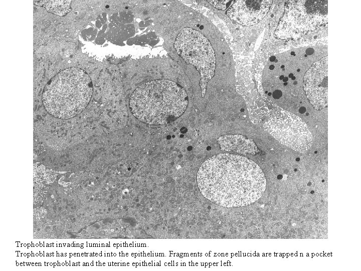 Trophoblast invading luminal epithelium. Trophoblast has penetrated into the epithelium. Fragments of zone pellucida