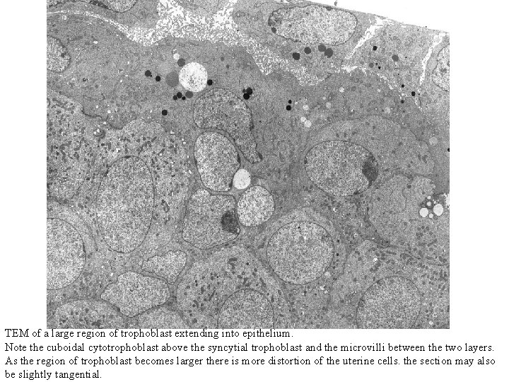 TEM of a large region of trophoblast extending into epithelium. Note the cuboidal cytotrophoblast