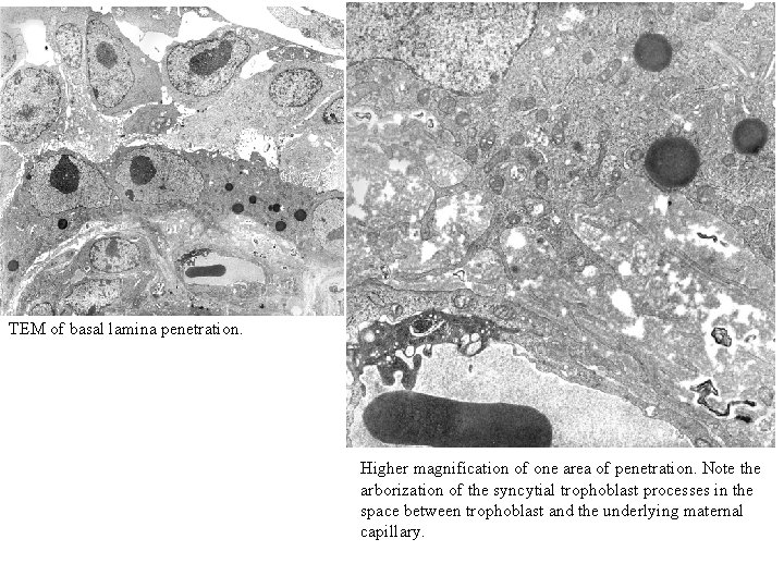 TEM of basal lamina penetration. Higher magnification of one area of penetration. Note the