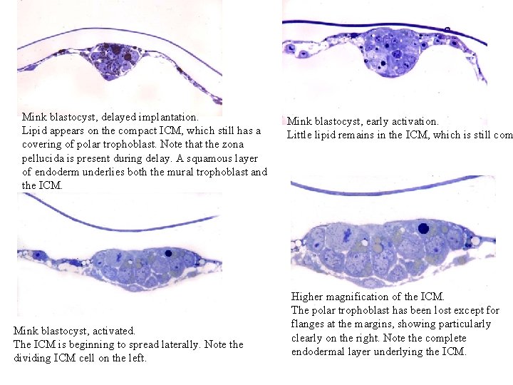 Mink blastocyst, delayed implantation. Lipid appears on the compact ICM, which still has a