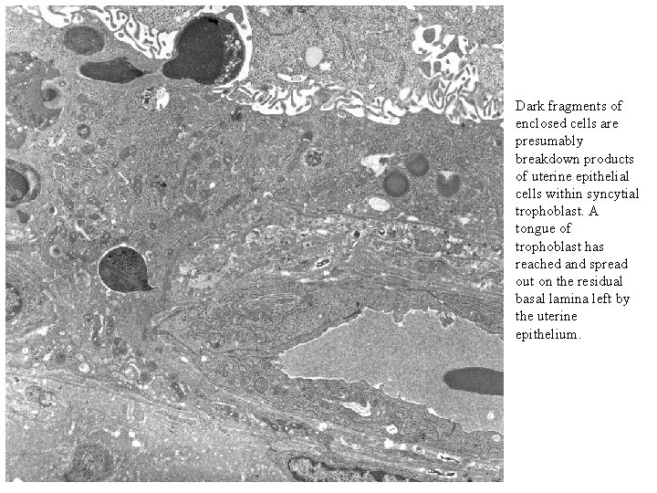 Dark fragments of enclosed cells are presumably breakdown products of uterine epithelial cells within