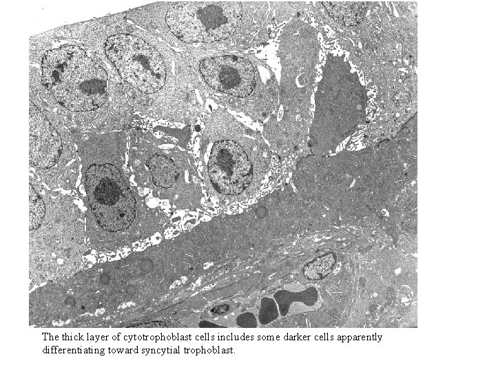 The thick layer of cytotrophoblast cells includes some darker cells apparently differentiating toward syncytial