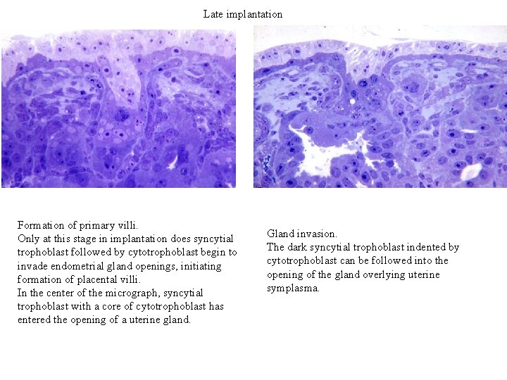 Late implantation Formation of primary villi. Only at this stage in implantation does syncytial