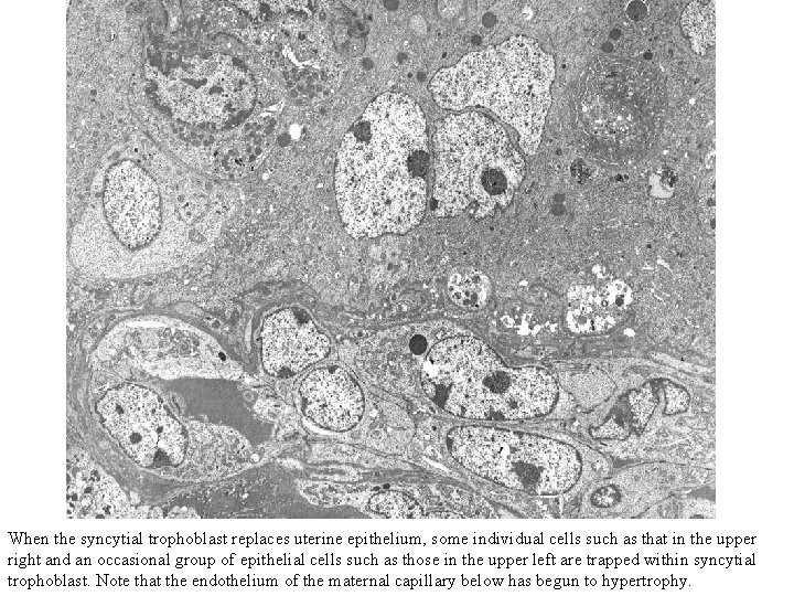 When the syncytial trophoblast replaces uterine epithelium, some individual cells such as that in