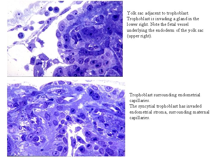 Yolk sac adjacent to trophoblast. Trophoblast is invading a gland in the lower right.