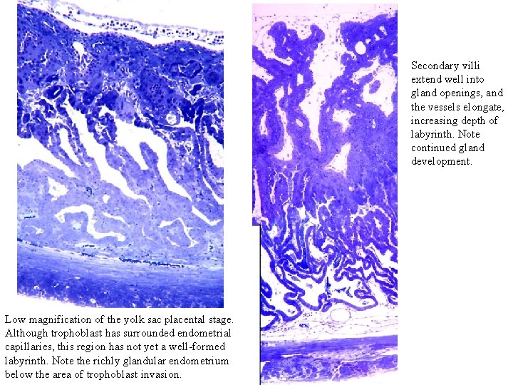 Secondary villi extend well into gland openings, and the vessels elongate, increasing depth of