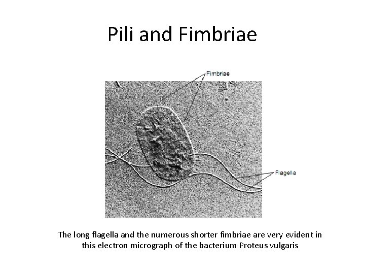 Pili and Fimbriae The long flagella and the numerous shorter fimbriae are very evident