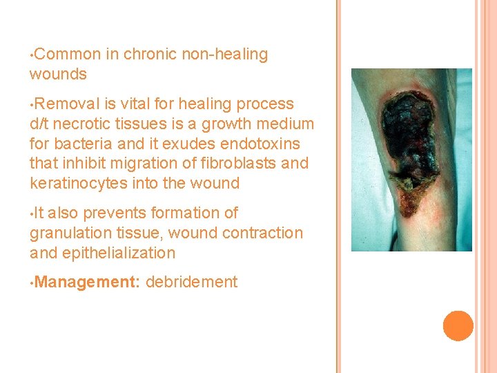  • Common in chronic non-healing wounds • Removal is vital for healing process