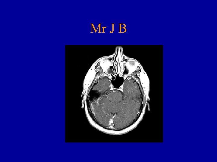 Mr J B 