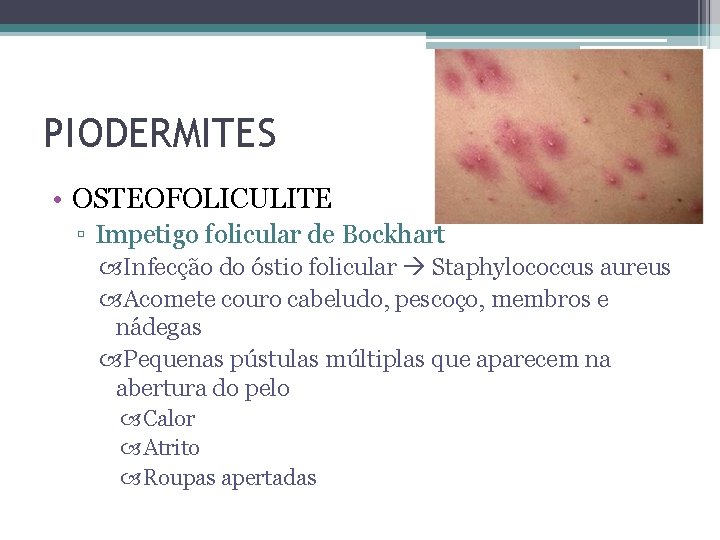 PIODERMITES • OSTEOFOLICULITE ▫ Impetigo folicular de Bockhart Infecção do óstio folicular Staphylococcus aureus