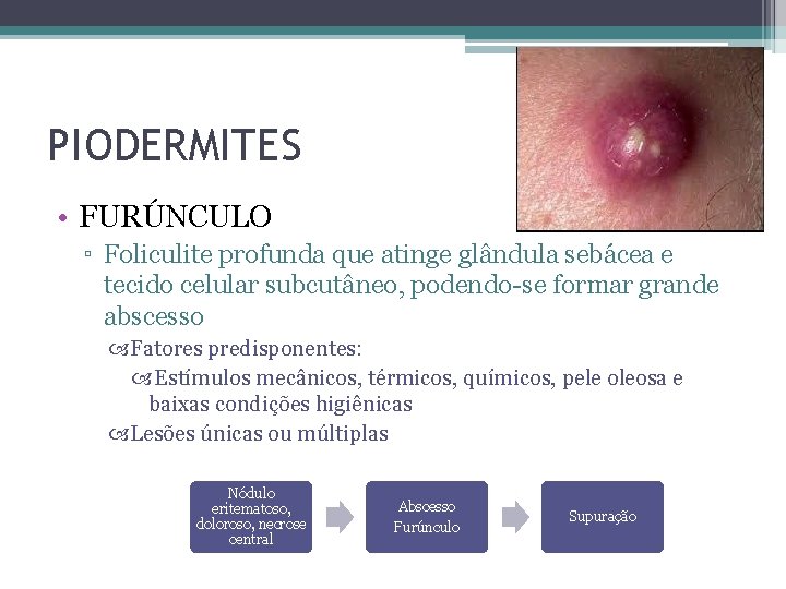 PIODERMITES • FURÚNCULO ▫ Foliculite profunda que atinge glândula sebácea e tecido celular subcutâneo,