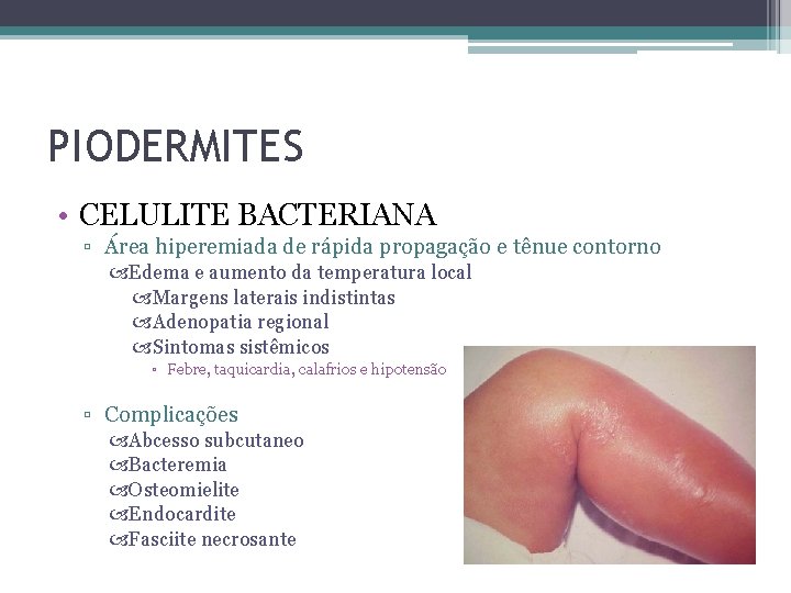 PIODERMITES • CELULITE BACTERIANA ▫ Área hiperemiada de rápida propagação e tênue contorno Edema