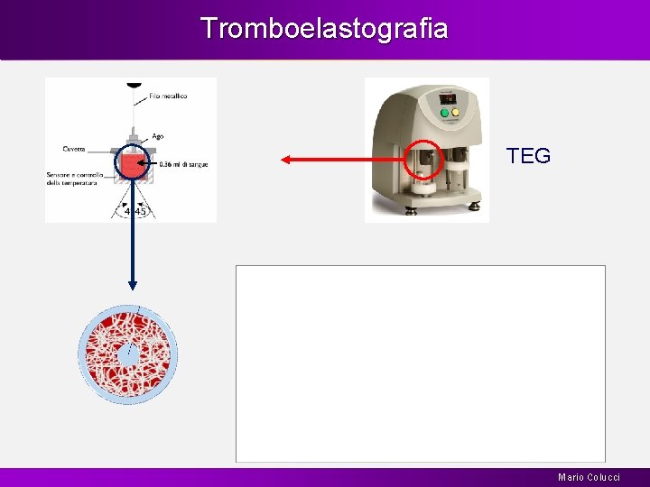 Tromboelastografia TEG Mario Colucci 