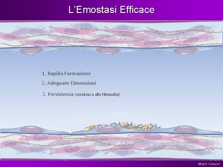 L’Emostasi Efficace 1. Rapida Formazione 2. Adeguate Dimensioni 3. Persistenza (resistenza alla Fibrinolisi) Mario